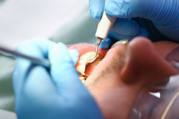 Best Orthodontic Emergency Dentist in Hoschton, GA